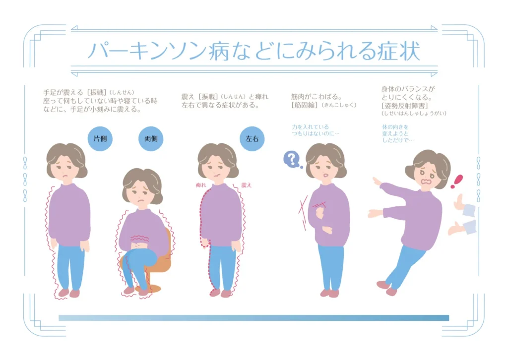 パーキンソン病の症状